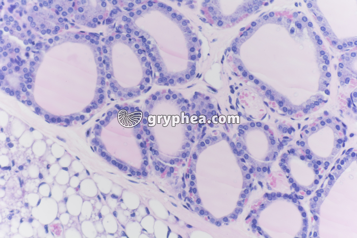 Thyroïde en hyperactivité x100 - gryphea.com